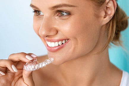 Invisalign em Belo Horizonte